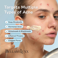 BellamiLuxx tea tree oil ingredient highlight for blemish support