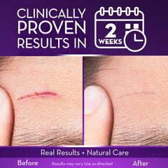 Cicatricure gel texture drop illustrating lightweight absorption