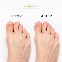 DAILY REMEDY foot soak in basin in-use showing relaxation and odor reduction