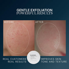 ELEMIS smooth pad soaked with solution highlighting lactic acid benefit