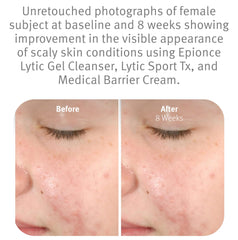 Epionce foam lather on hand demonstrating effective gentle cleansing