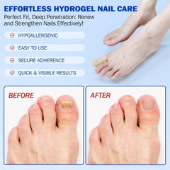 FANSHI patch applied to toenail demonstrating secure overnight fit