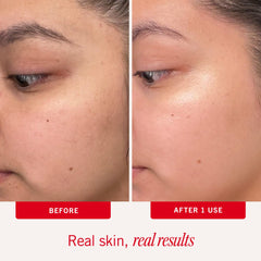 First Aid Beauty close-up of pad texture revealing gentle exfoliating bumps