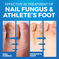 Imperial Feet being sprayed inside a shoe to prevent fungal reinfection