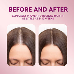 Lavtek being applied to scalp demonstration with dropper, supports targeted use