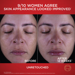 L'Oreal Paris pro-retinol ingredient visual supporting smoother skin
