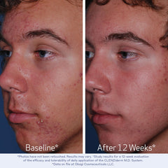 Obagi Medical close-up of salicylic acid info highlighting exfoliation benefit
