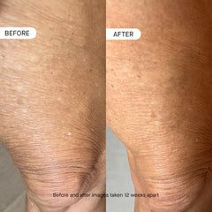 oneskin OS-01 BODY applied to forearm showing smoothing and barrier support