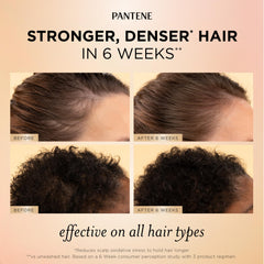 Applying Pantene serum along scalp line to show targeted root support and coverage