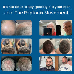 Peptonix application on scalp demonstrating targeted weekly treatment