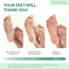 PLANTIFIQUE close-up of the bootie material and sealed inner pad for controlled exfoliation