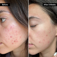 QRxLabs close-up pad texture showing soft non-woven surface for gentle exfoliation