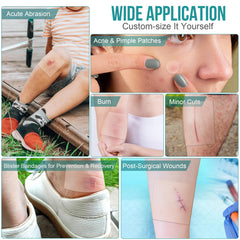 YHOVID cut-to-size dressing illustrating customization and precise coverage