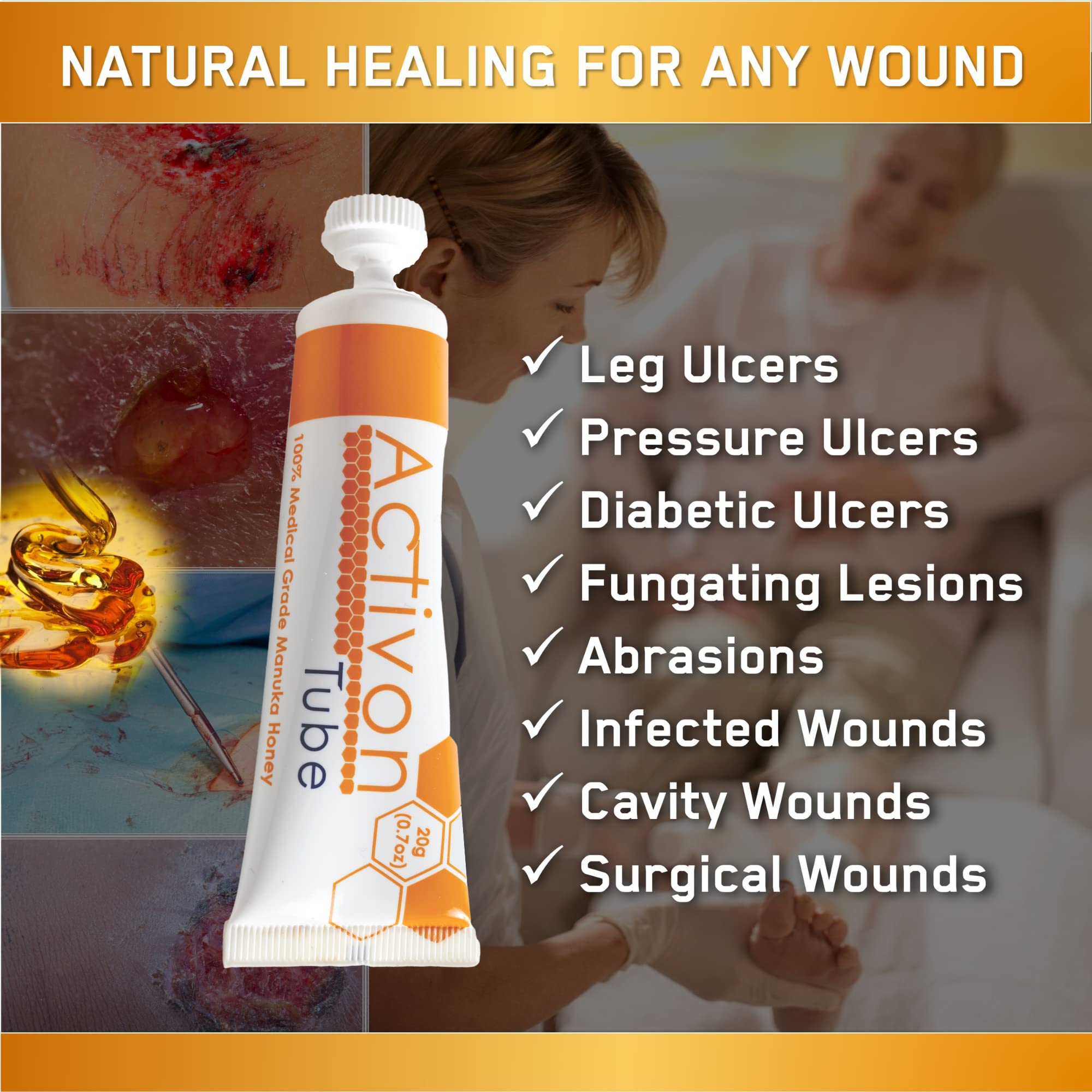 ActivOn being applied to wound bed illustrating controlled dressing application