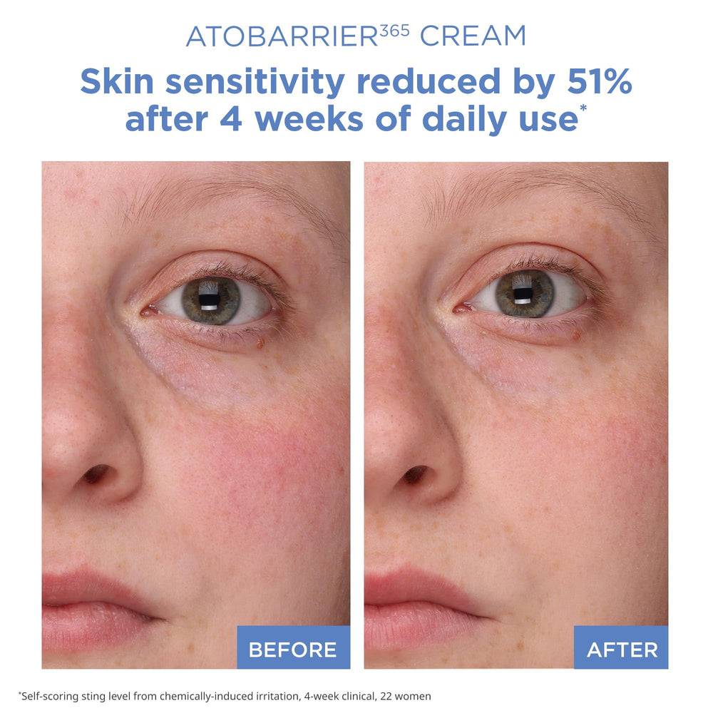 AESTURA hand applying cream illustrating gentle barrier support
