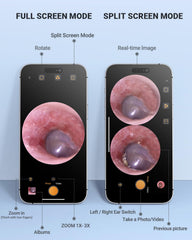 AnyScope speculum and silicone spoon attached for safer ear access