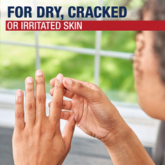 Aquaphor applied to chapped lips for fast soothing relief