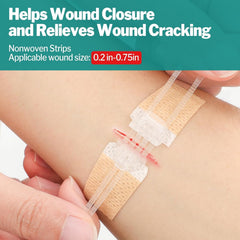 AZEN butterfly bandage detail showing adhesive edge for gentle support