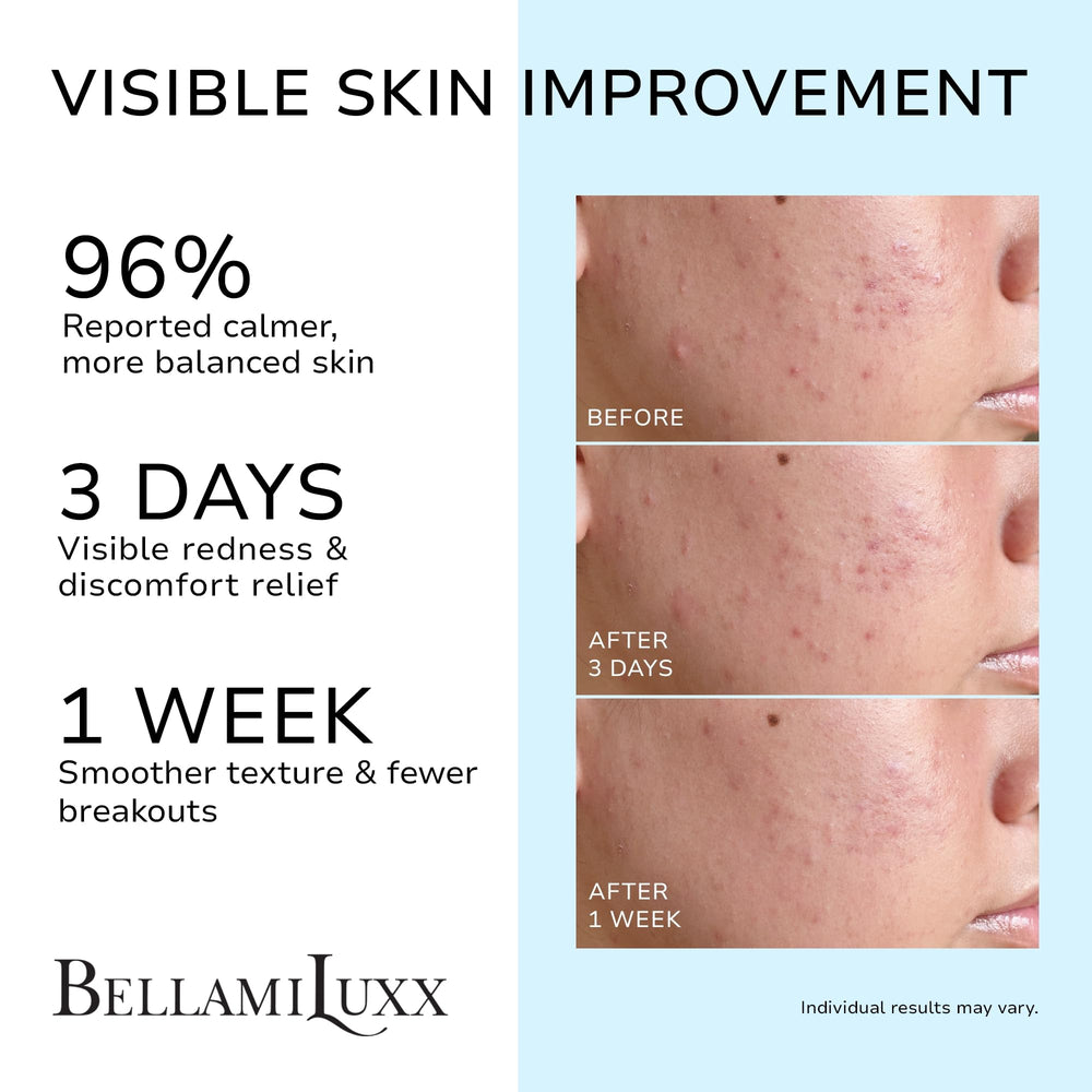 BellamiLuxx cream texture close-up demonstrating lightweight hydration