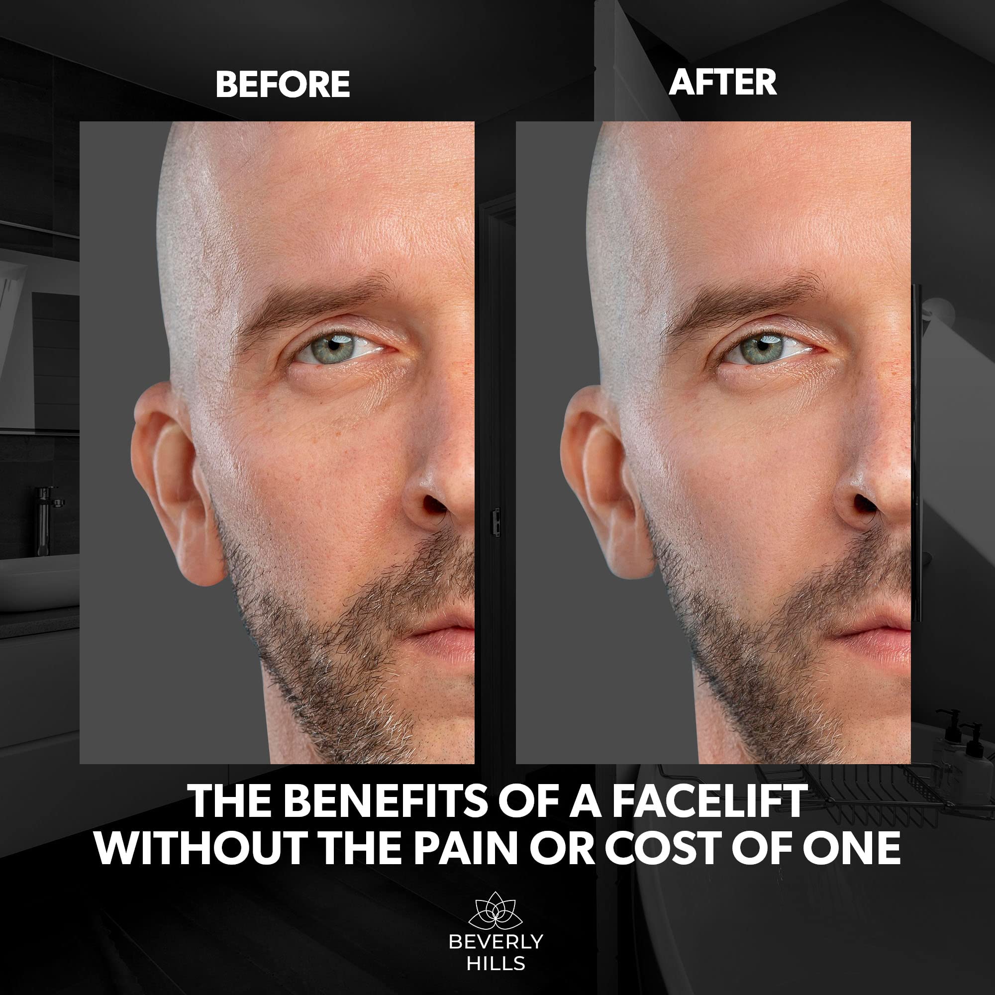 Beverly Hills application under-eye demonstrating reduced puffiness benefit
