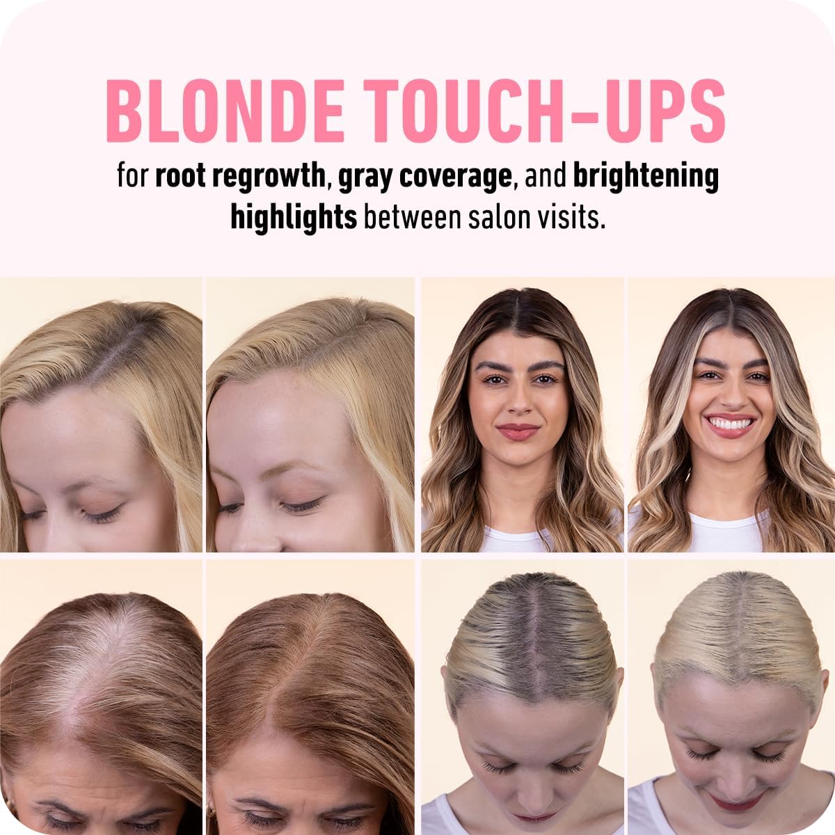 Before and after using Boldify Dark Blonde showing fuller hairline benefit