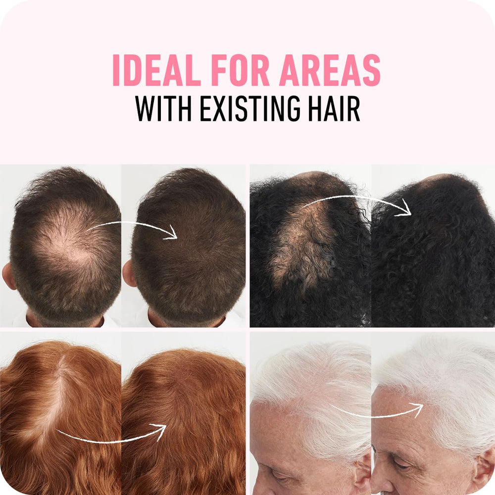 Boldify being applied to crown showing instant volume and concealed thinning
