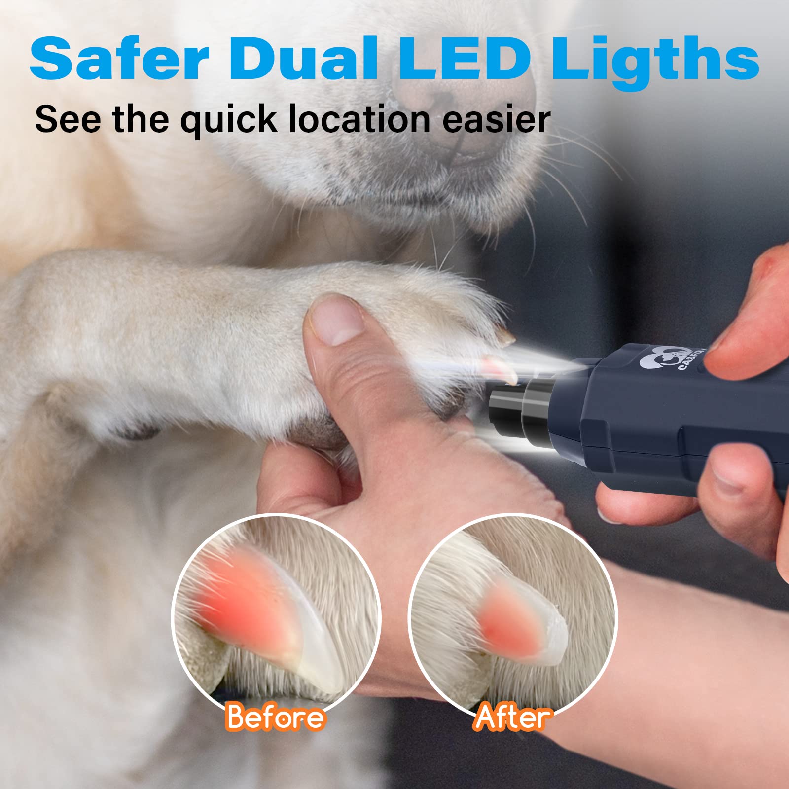 Casfuy dual LED lights illuminating nail for safer precise trimming benefit