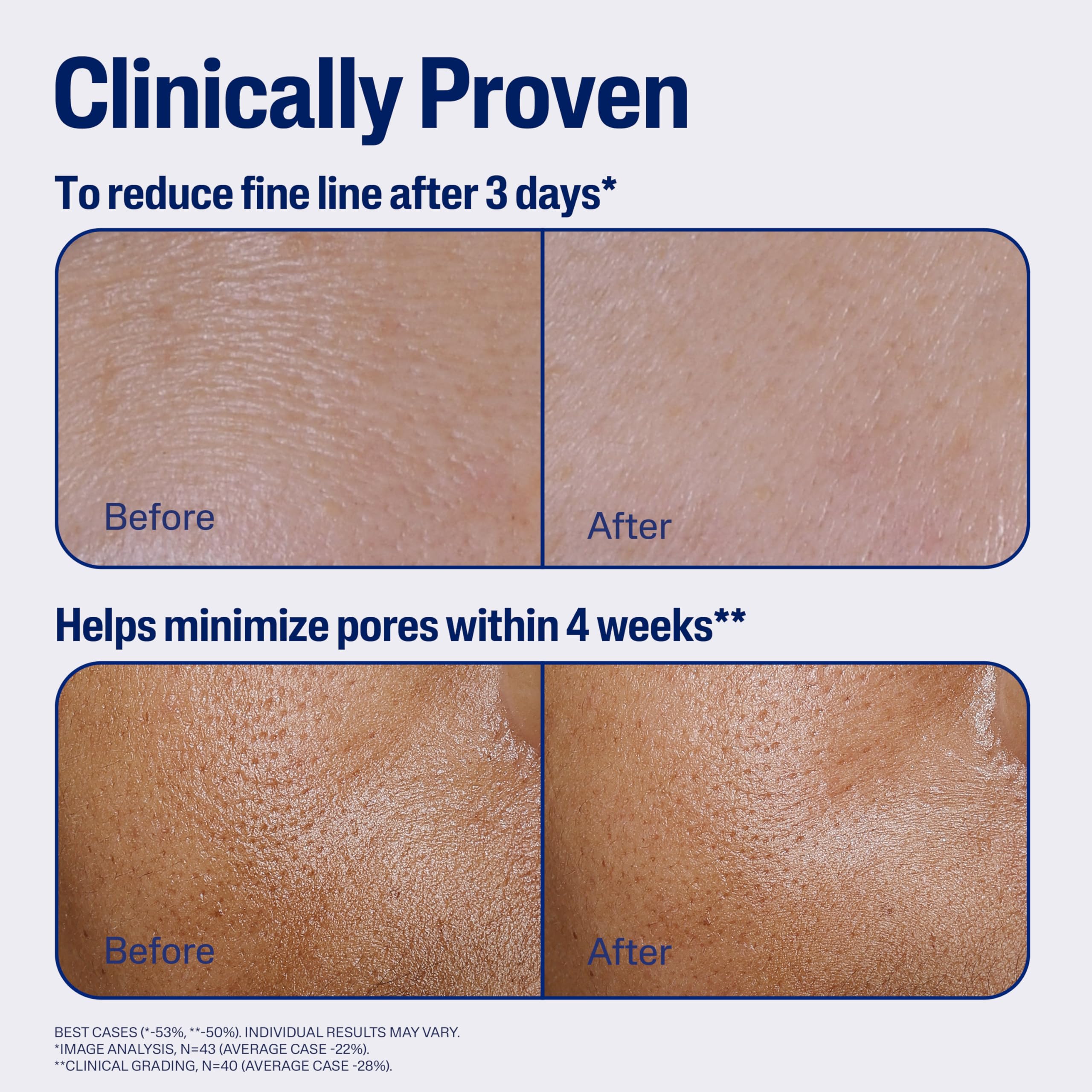 Cetaphil 1oz serum beside sunscreen showing morning routine layering benefit