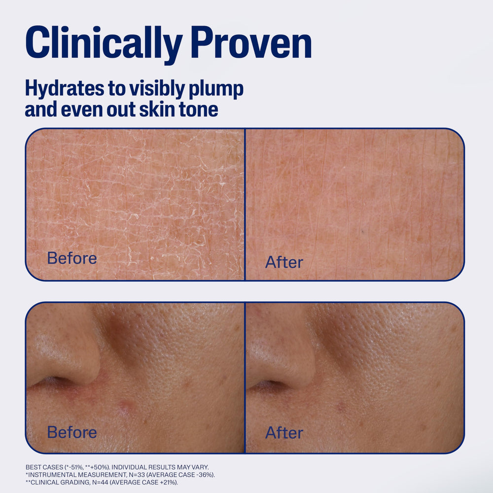 Serum on skin close-up showing smooth hydrated texture with Cetaphil