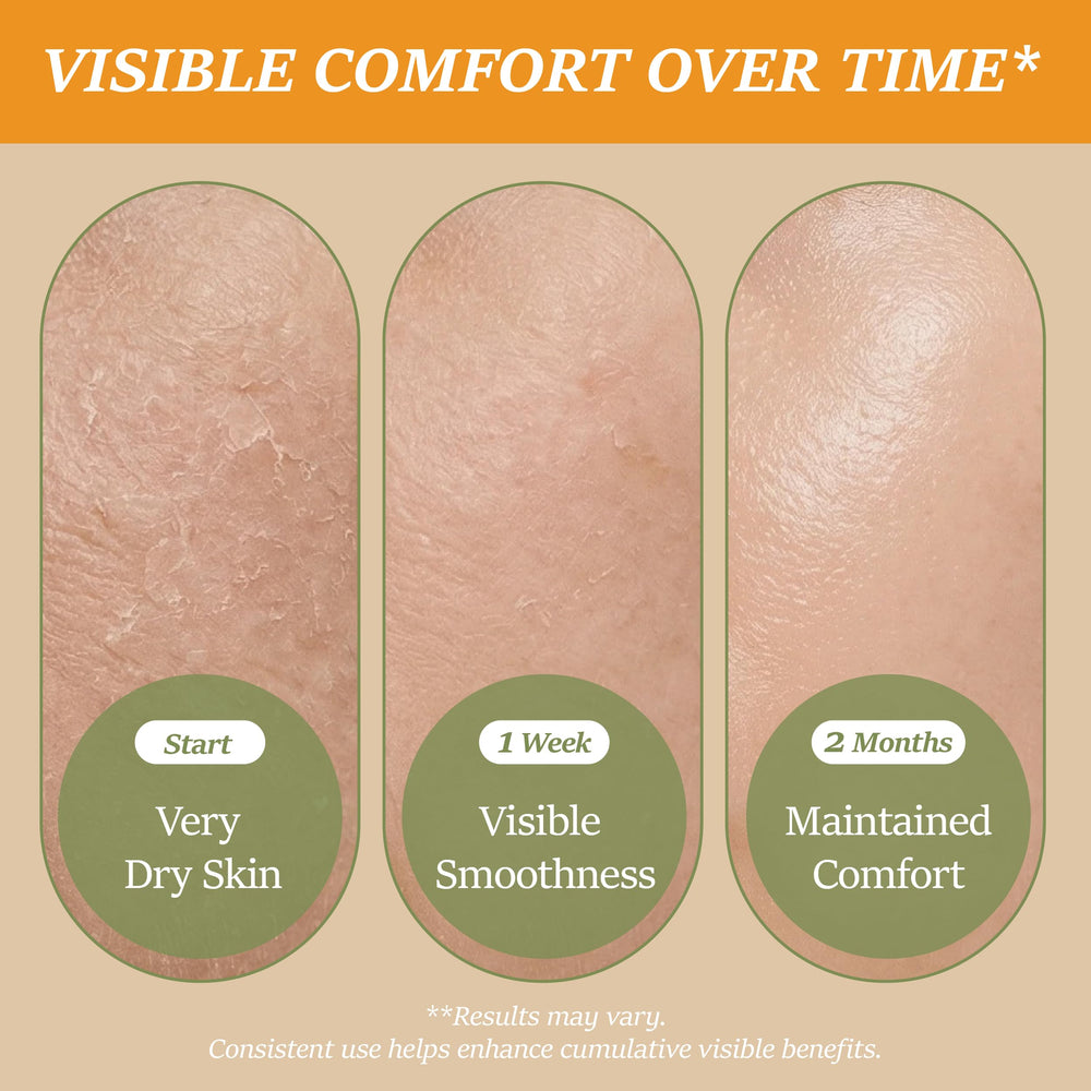 ChiroLife used on lips and cuticles to soothe and reduce dryness