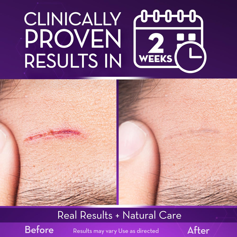 Cicatricure gel texture drop illustrating lightweight absorption