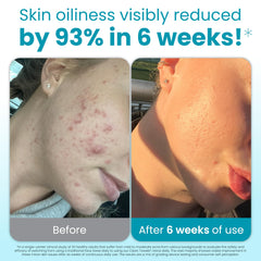 CLEAN SKIN CLUB close-up of raised-dot texture highlighting effective exfoliation