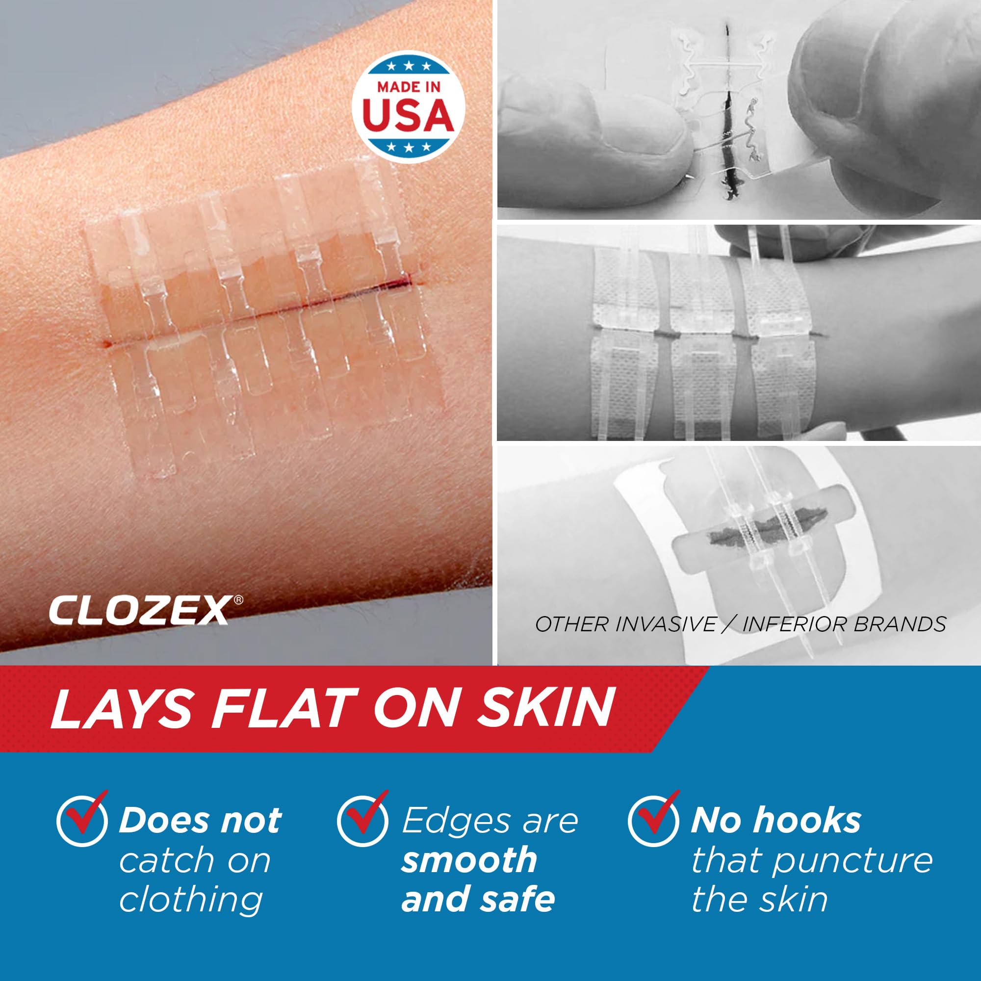 Clozex applied to a fingertip demonstrating quick non-invasive closure