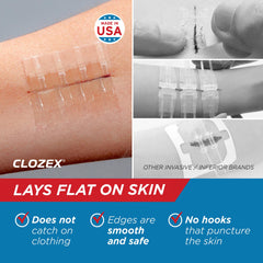 Clozex applied to a fingertip demonstrating quick non-invasive closure