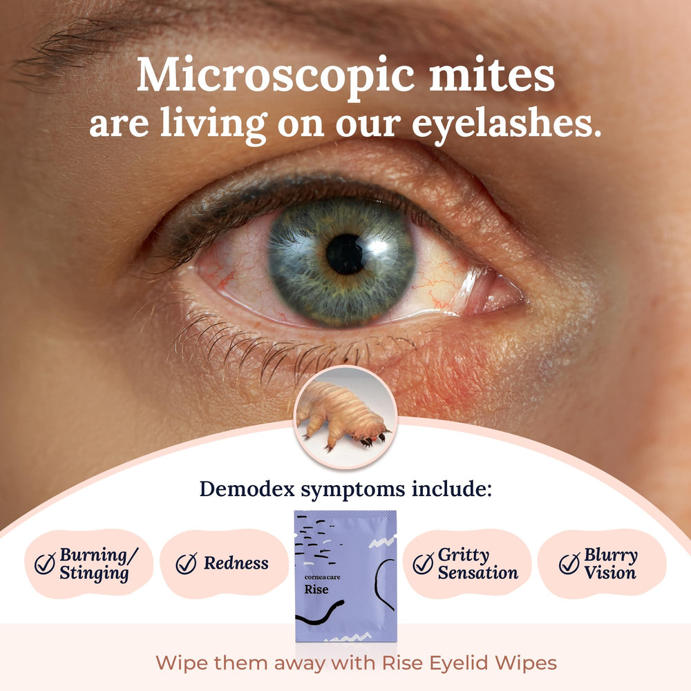 CorneaCare Rise being used on eyelid demonstrating safe, gentle cleaning