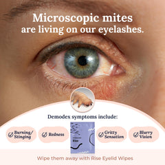 CorneaCare Rise being used on eyelid demonstrating safe, gentle cleaning