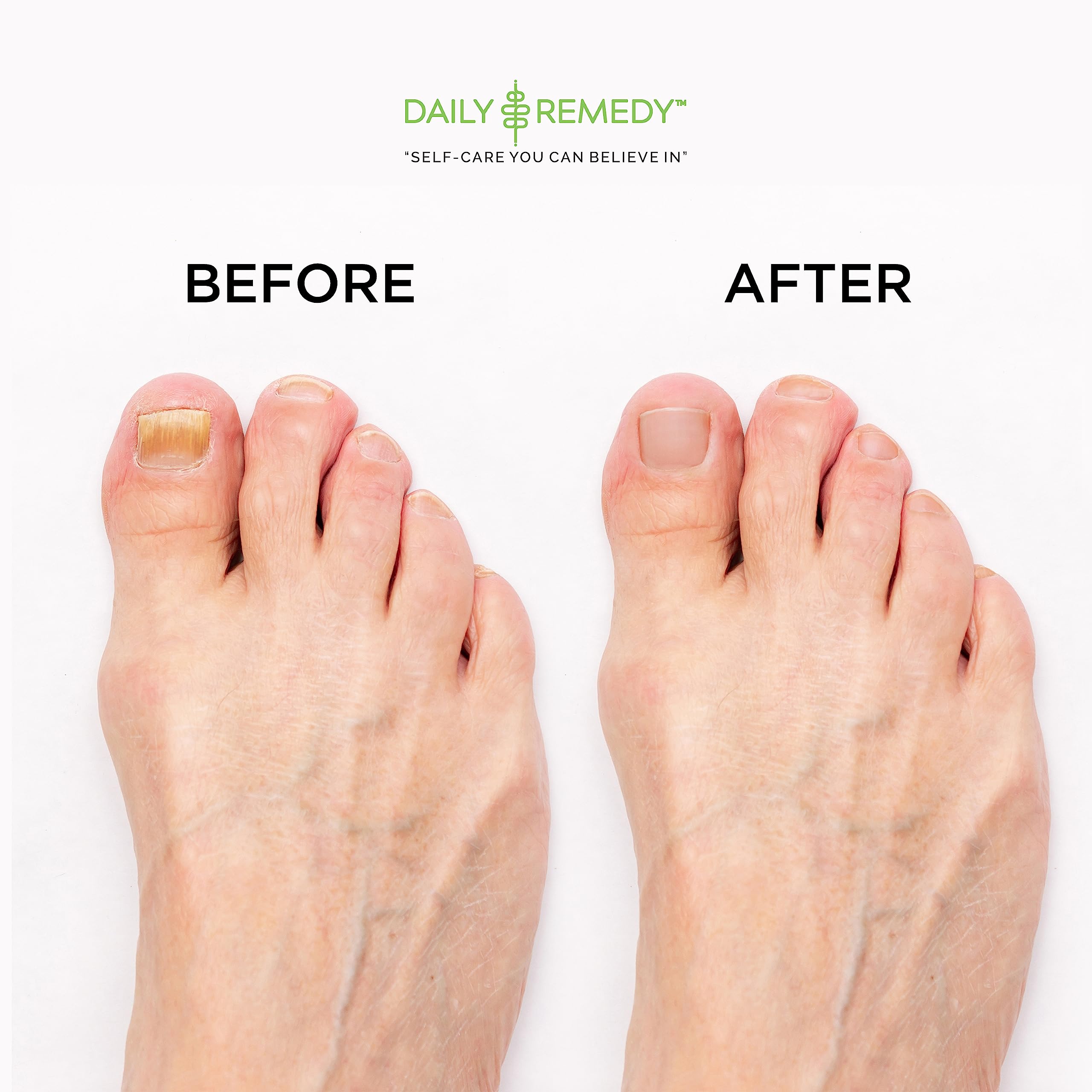 DAILY REMEDY foot soak in basin in-use showing relaxation and odor reduction
