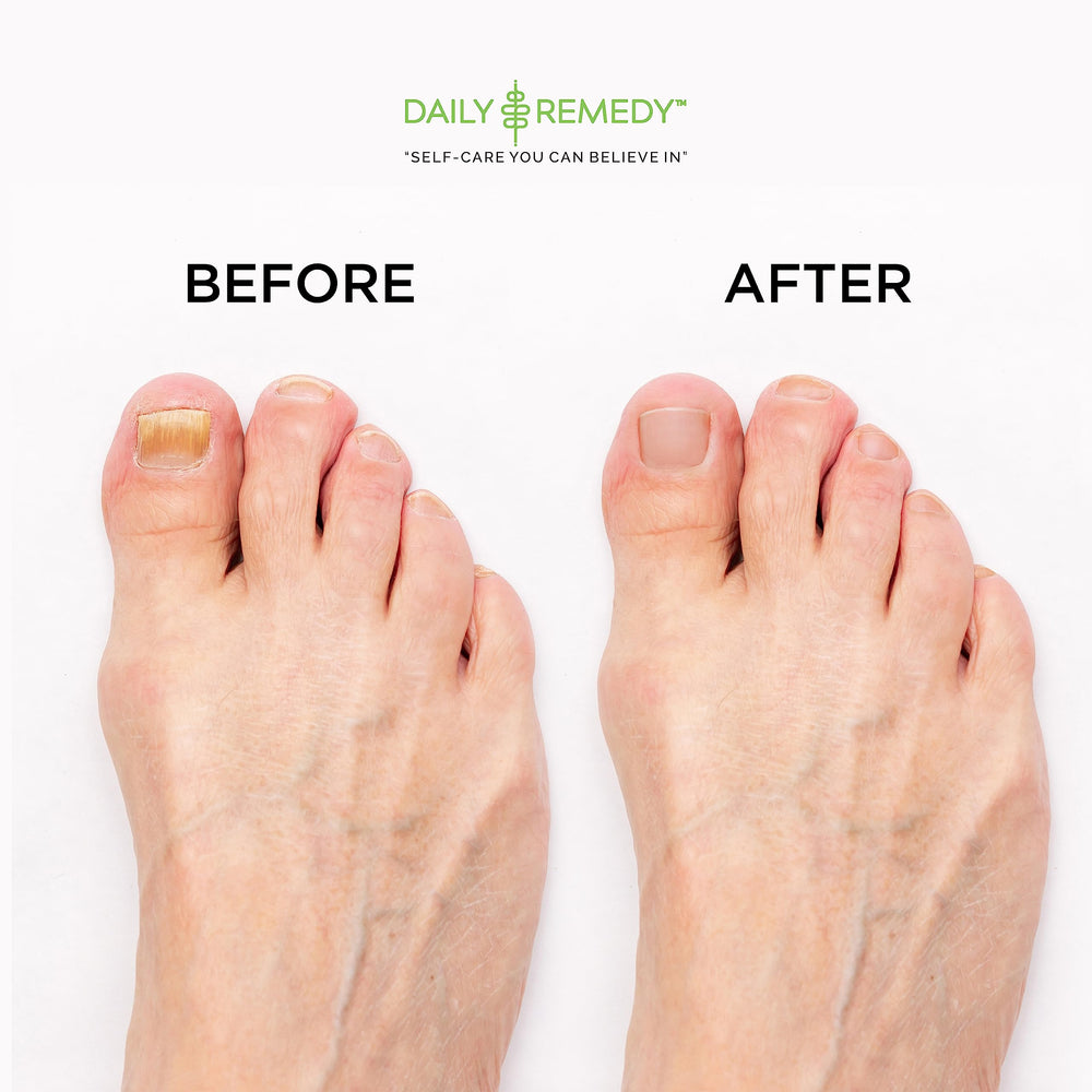 DAILY REMEDY foot soak in basin in-use showing relaxation and odor reduction