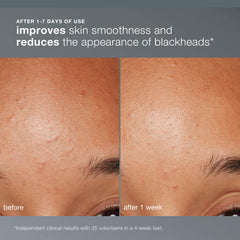 Dermalogica creamy paste in hands demonstrating activation benefit