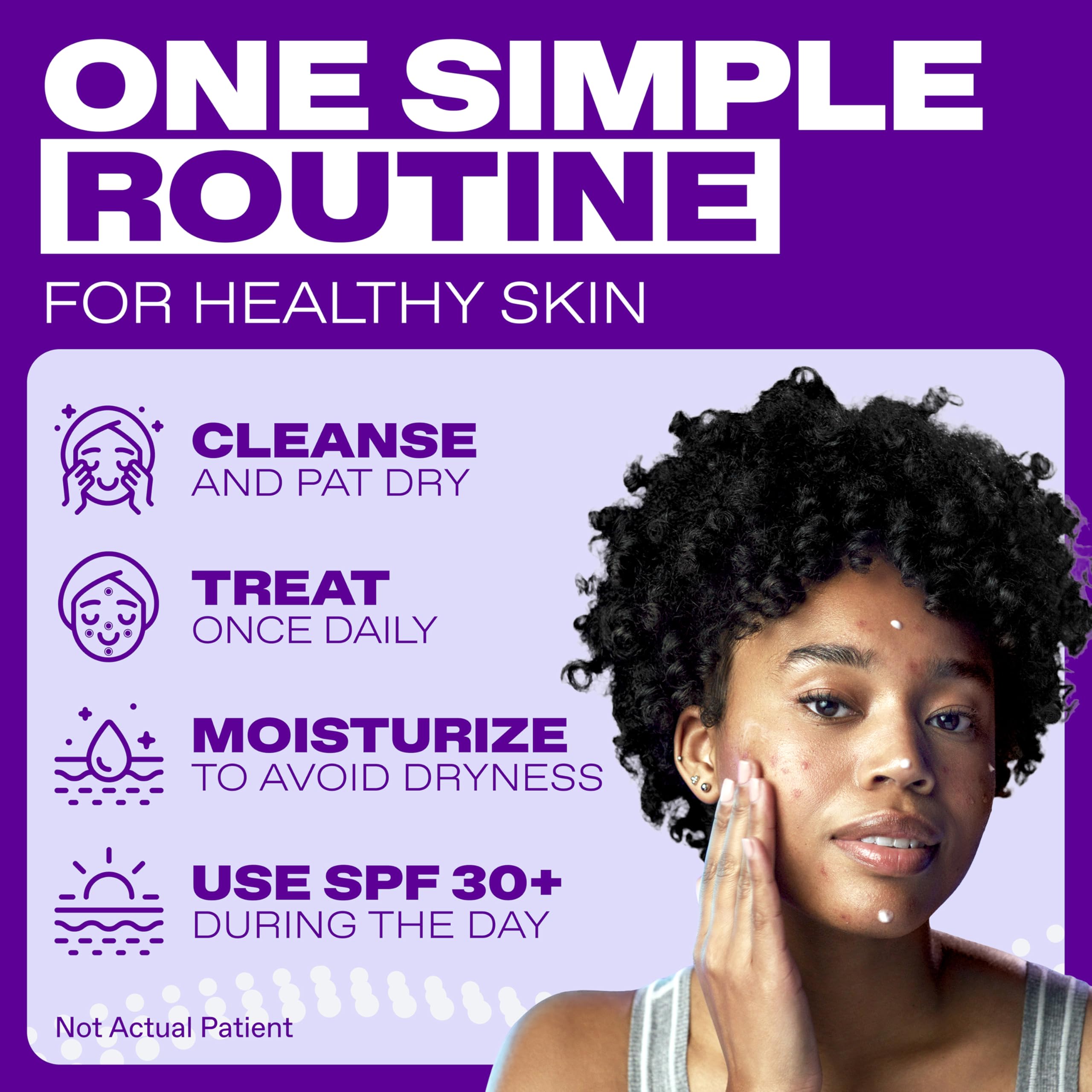 Model applying Differin Epiduo to face demonstrating targeted acne coverage and simplicity