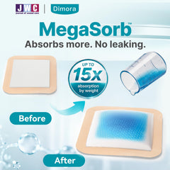 Dimora adhesive border detail highlighting gentle silicone for low-trauma dressing changes