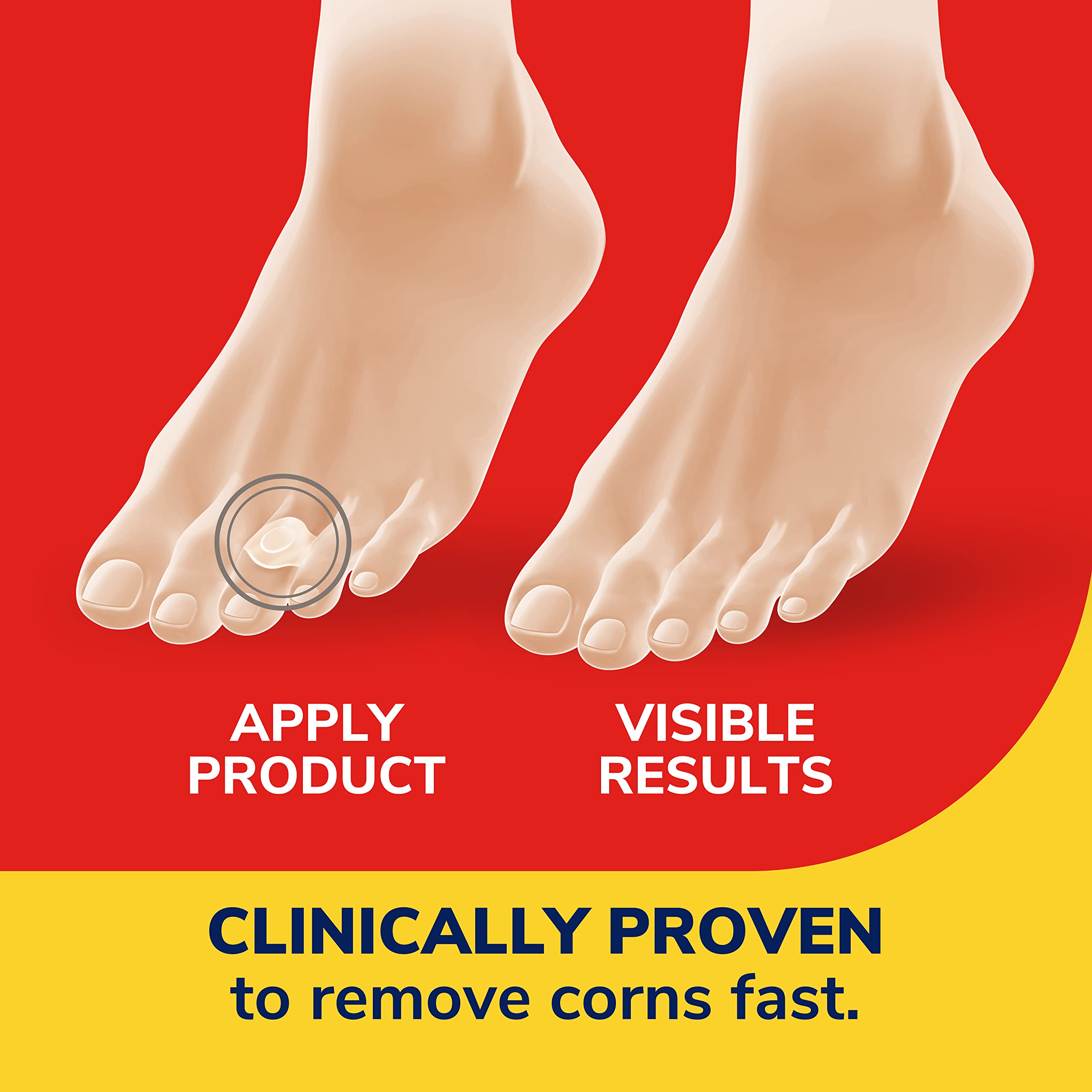 Dr. Scholl's bandage applied to toe demonstrating targeted protection