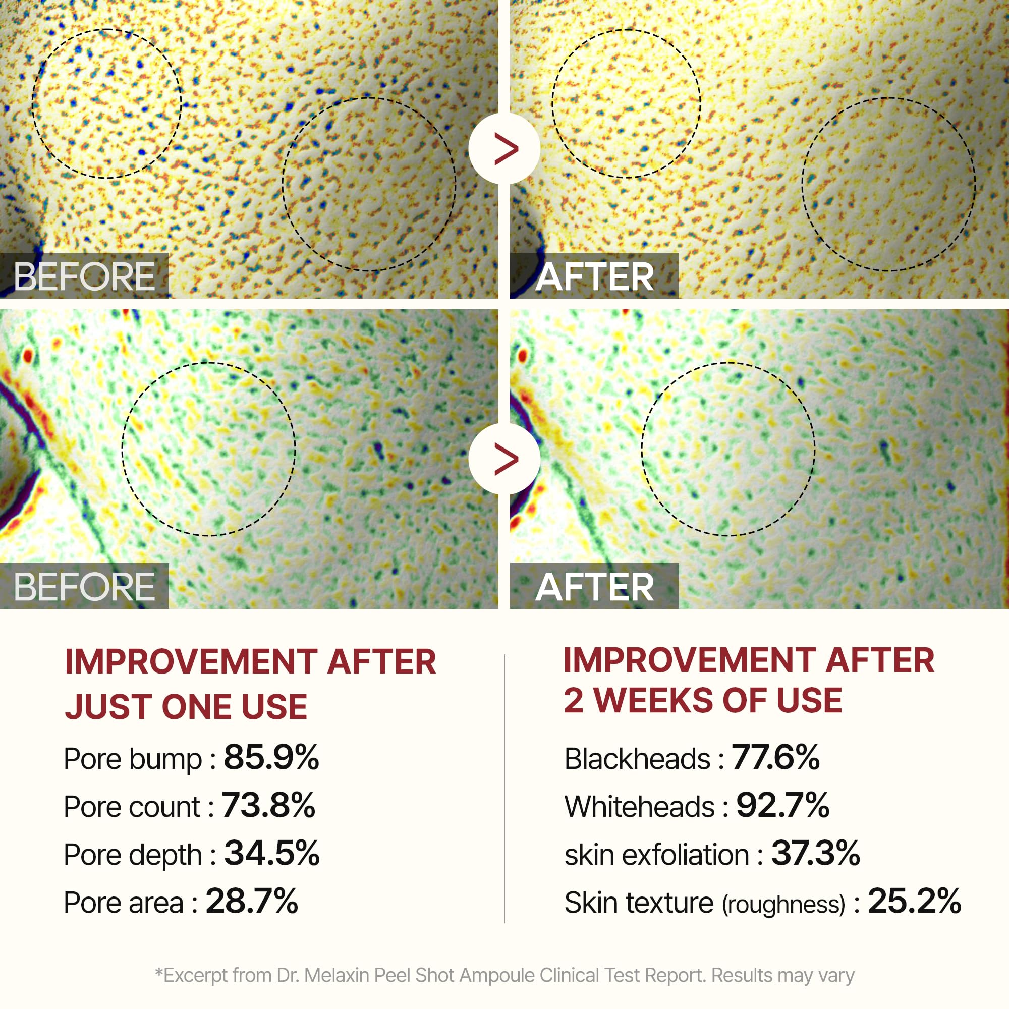 Dr.Melaxin before and after texture comparison illustrating smoother skin