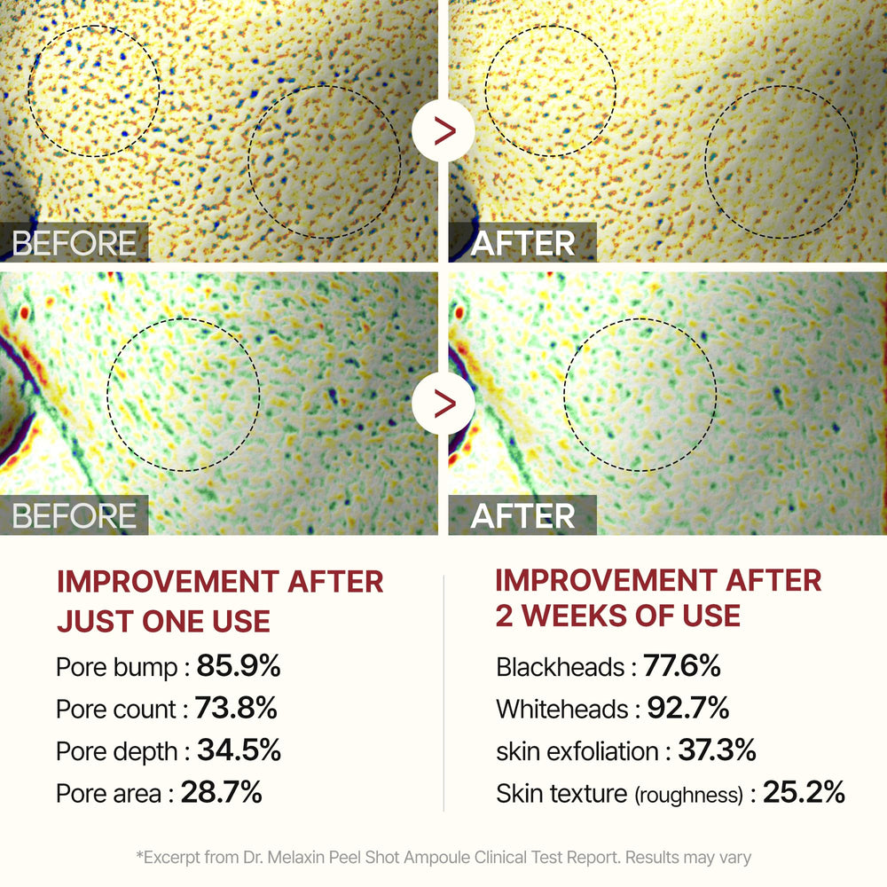 Dr.Melaxin before and after texture comparison illustrating smoother skin