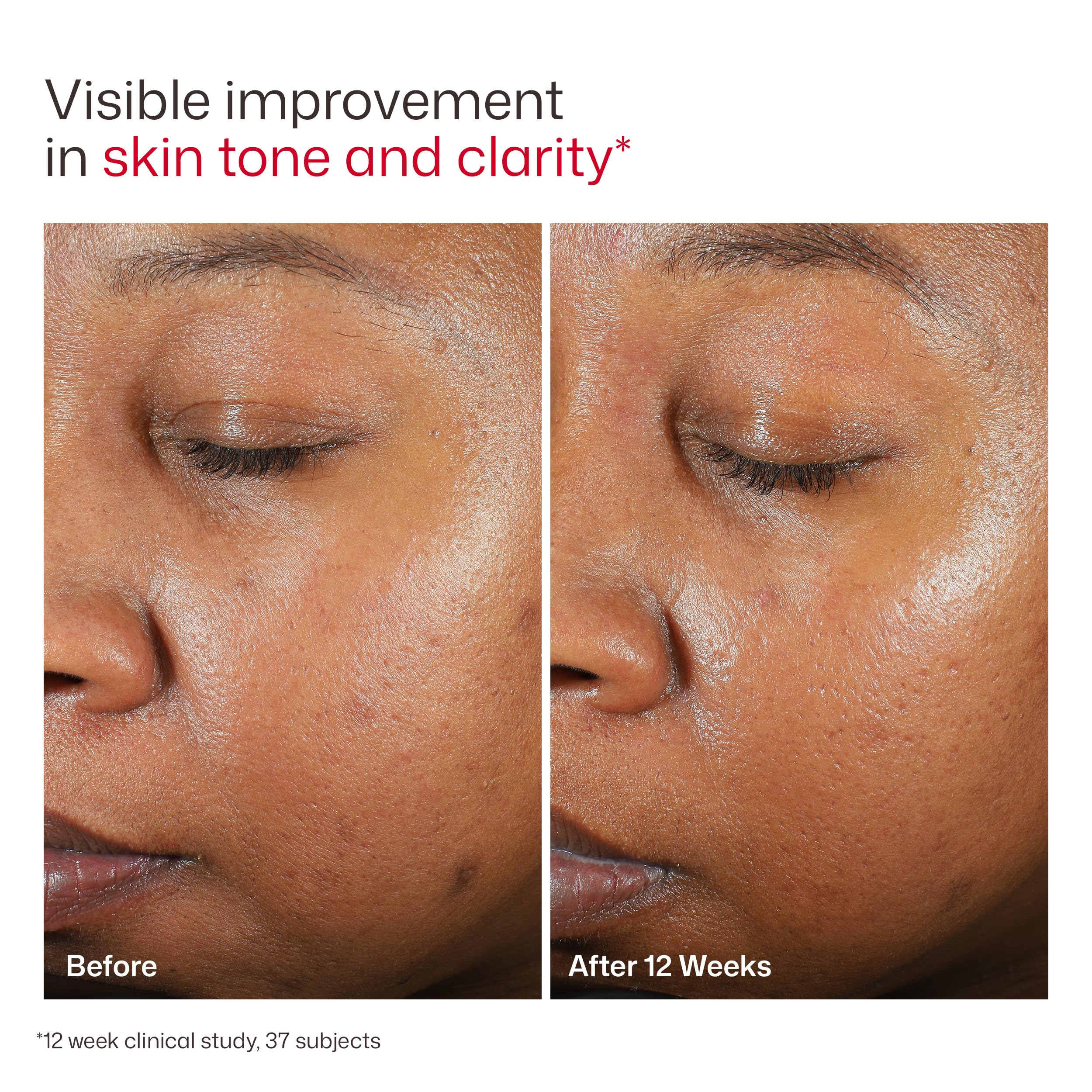 EltaMD before and after skin tone image showing improved visual evenness