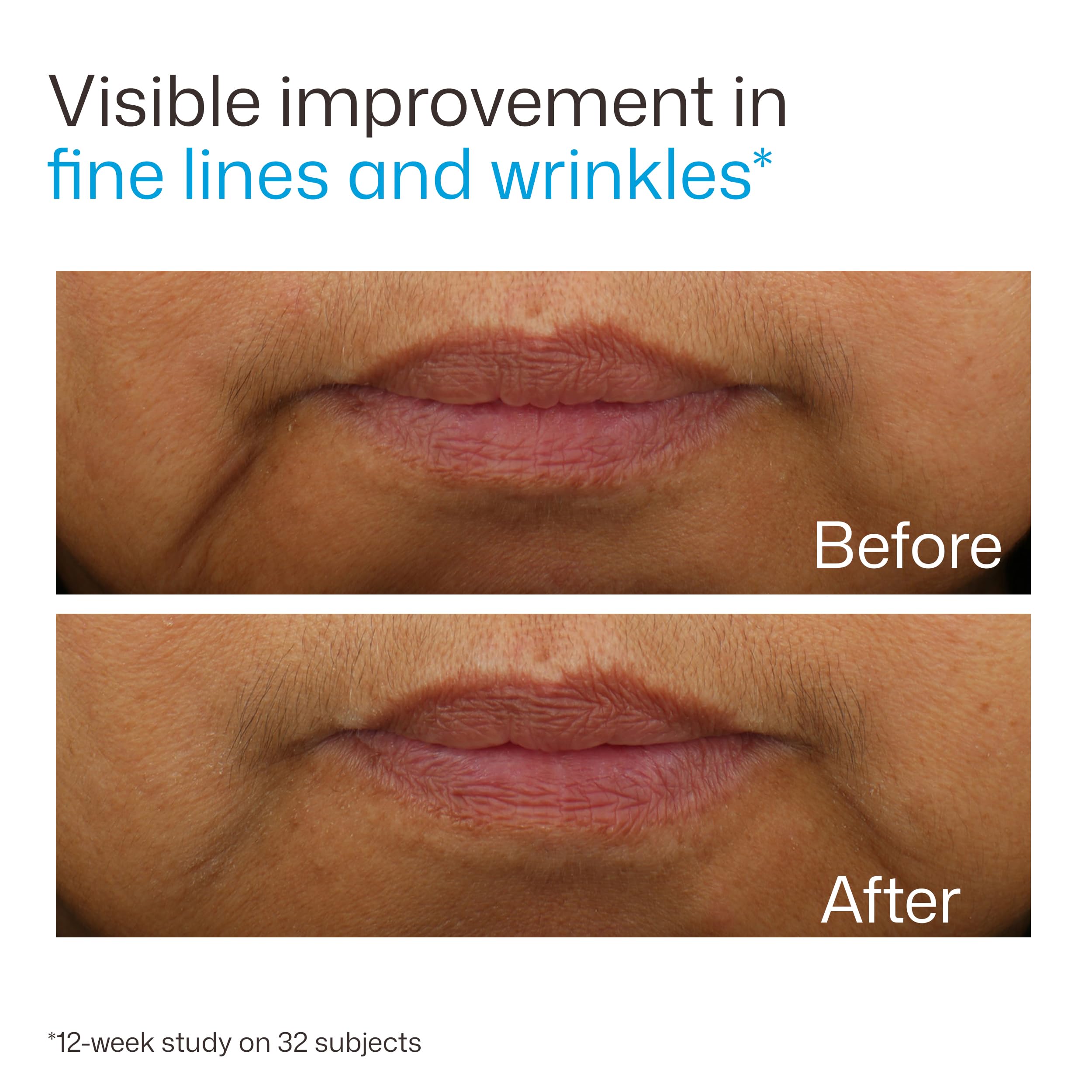 EltaMD before-and-after hydration comparison showing visibly plumper-looking skin