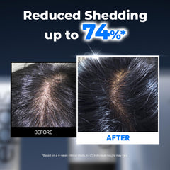 EPAIS comb tip detail with 38 tips for even scalp distribution benefit