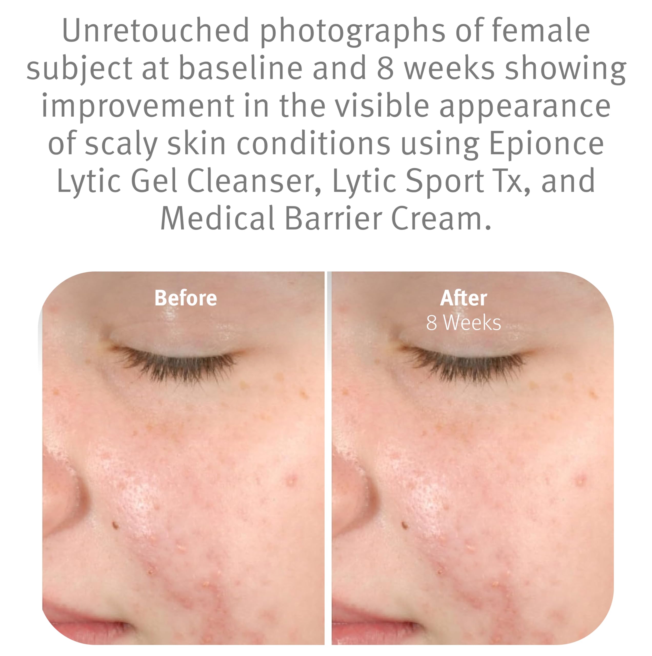 Epionce foam lather on hand demonstrating effective gentle cleansing
