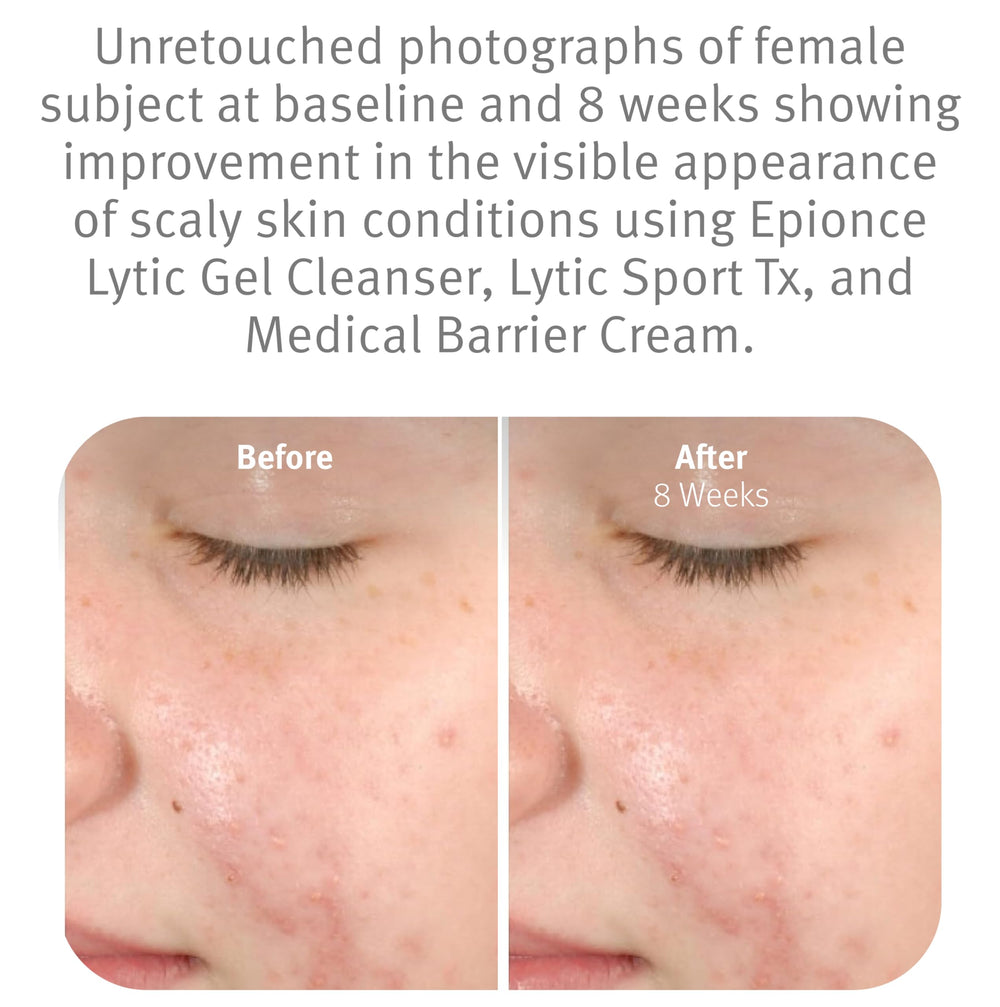 Epionce foam lather on hand demonstrating effective gentle cleansing