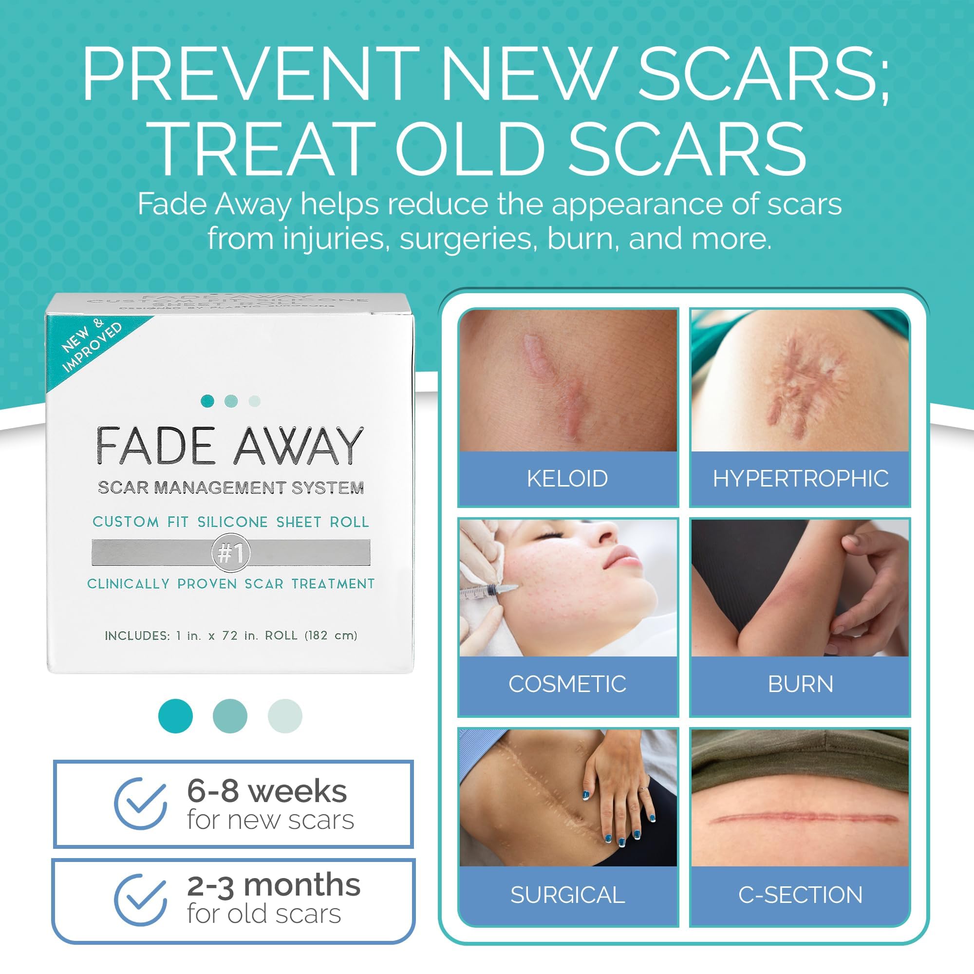 Fade Away applied to abdominal scar for discreet daily wear